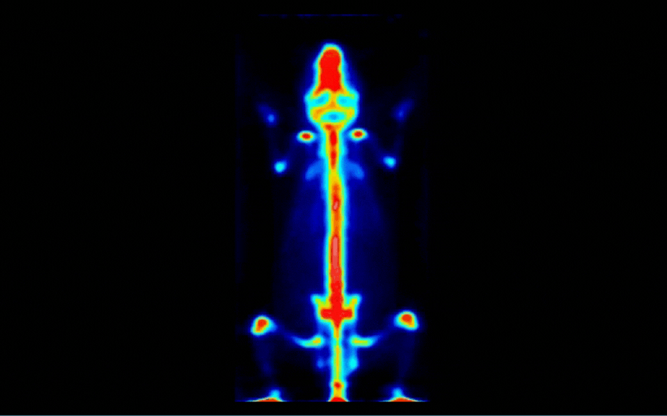 Bone imaging with FDG