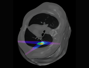 Monte Carlo Dosimetry