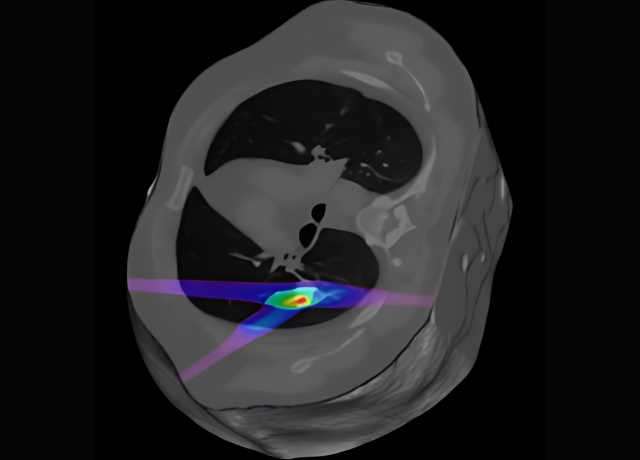 Monte Carlo Dosimetry