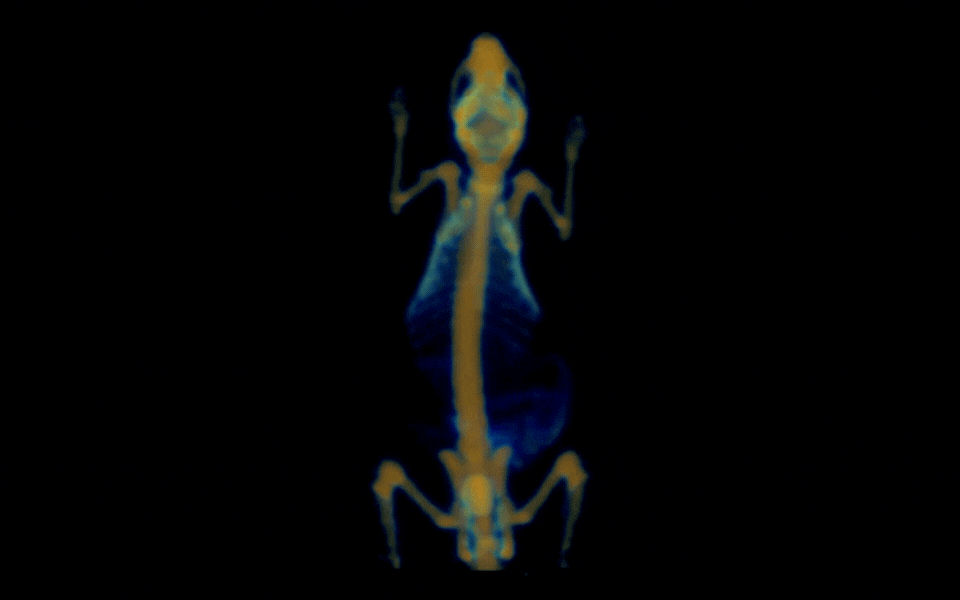 3D Bone imaging