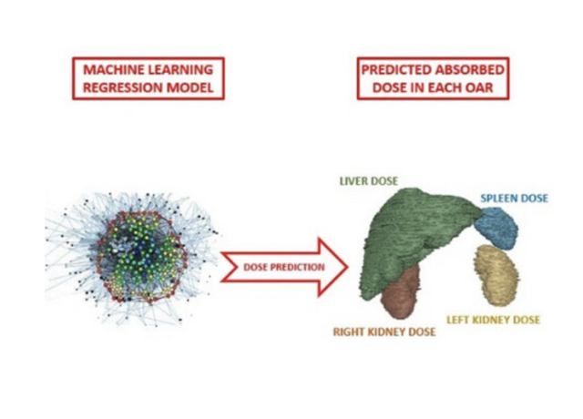 Radiomic and Dosiomic based ML Lu177